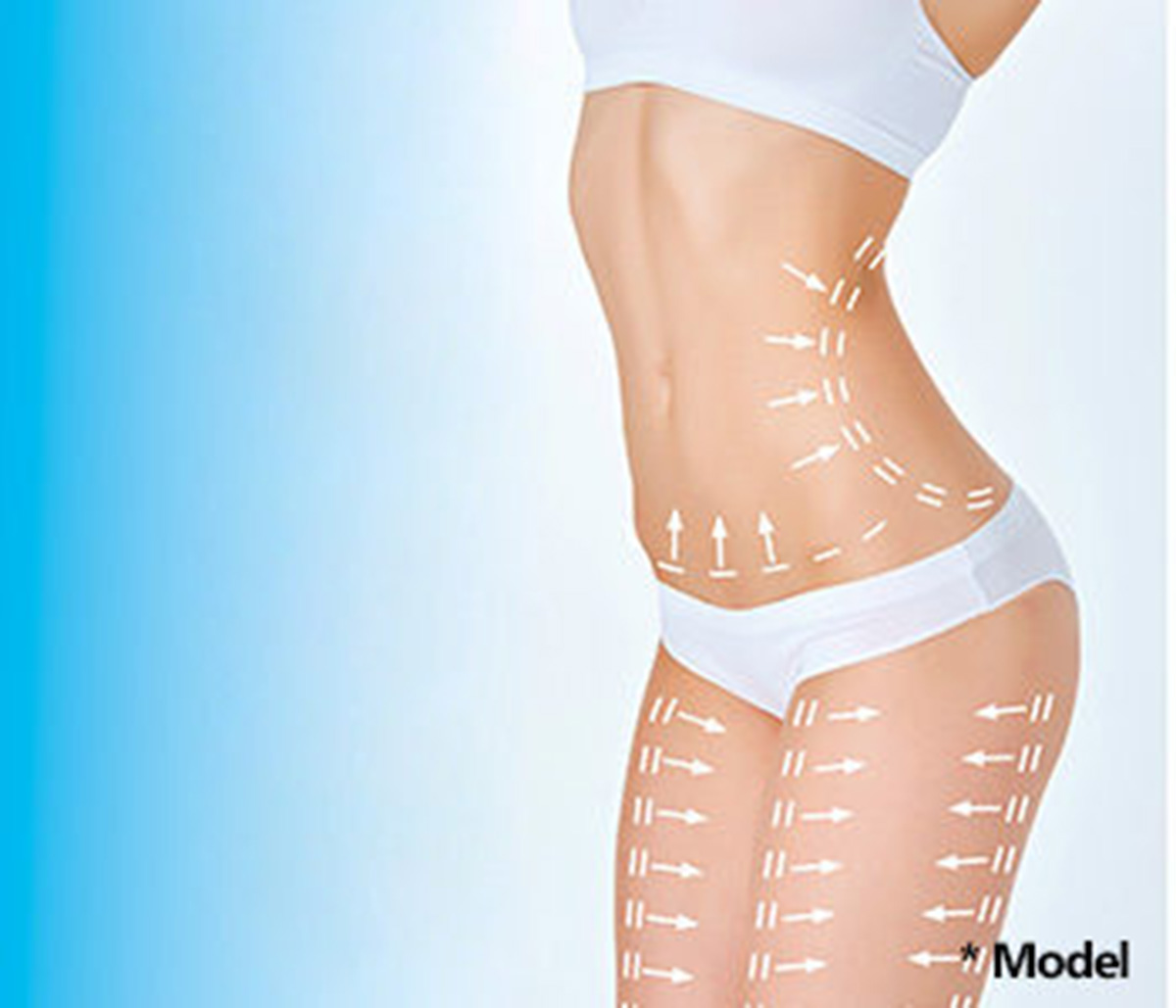 Liposculpture different from Liposuction