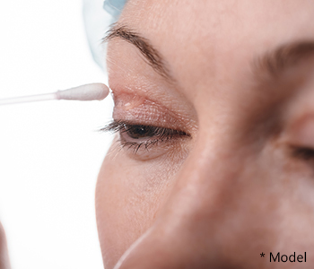 Dr. Dass describes upper eyelid surgery