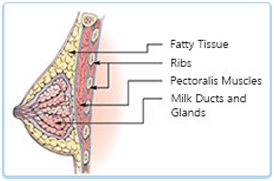 Breast Augmentation diagramtic explanataion 2